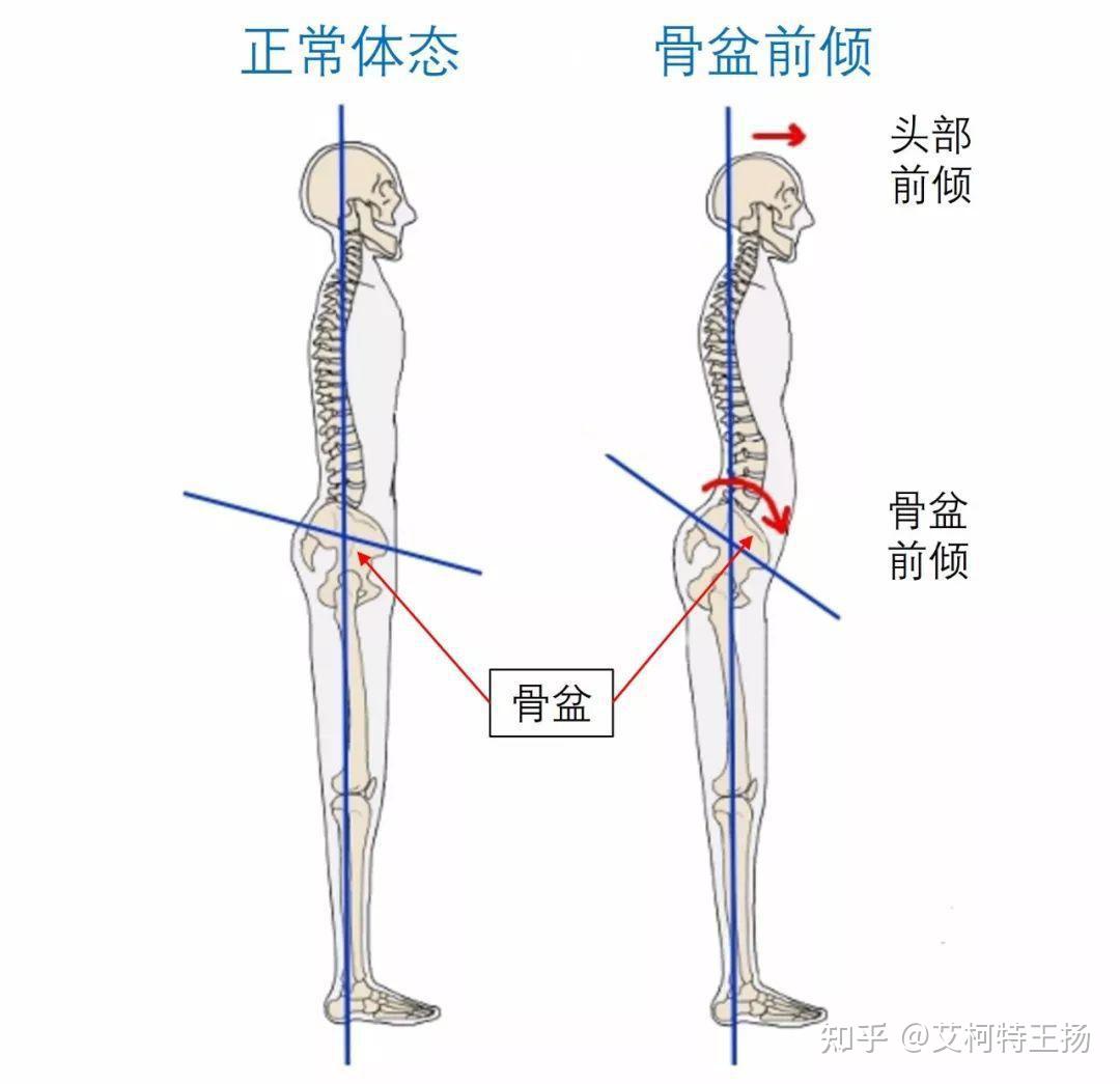 v2-b3a96a98ceacc12c94990ec1d235a364_r.jpg