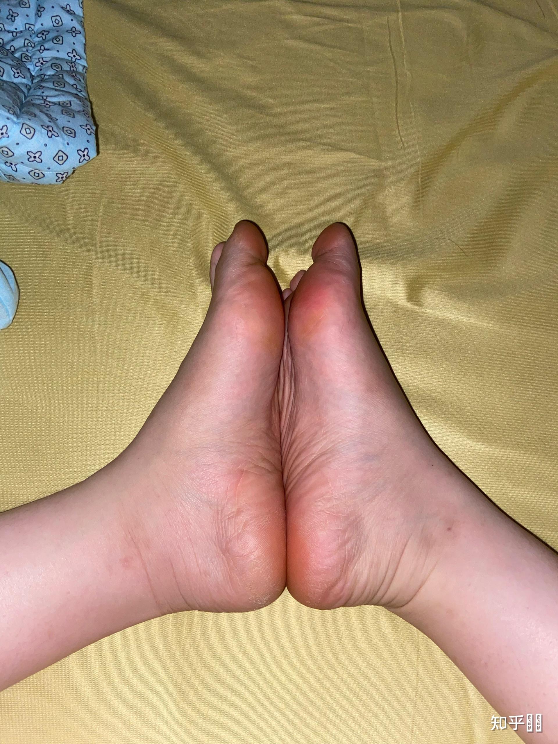 女生有一双很丑的脚有什么体验