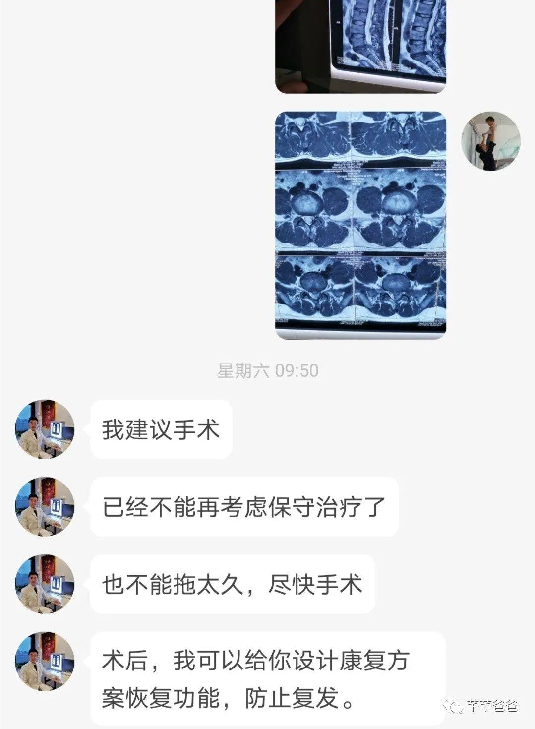 程序员腰突经历分享(中) 程序员腰突经历分享(中)