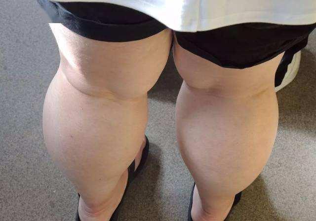 什么样的腿,才配拥有丝袜?