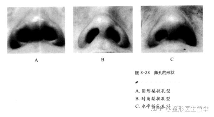 鼻整形科普:认识鼻背、鼻尖、鼻翼、鼻小柱、鼻孔分类,看看你属于哪个类型 - 知乎