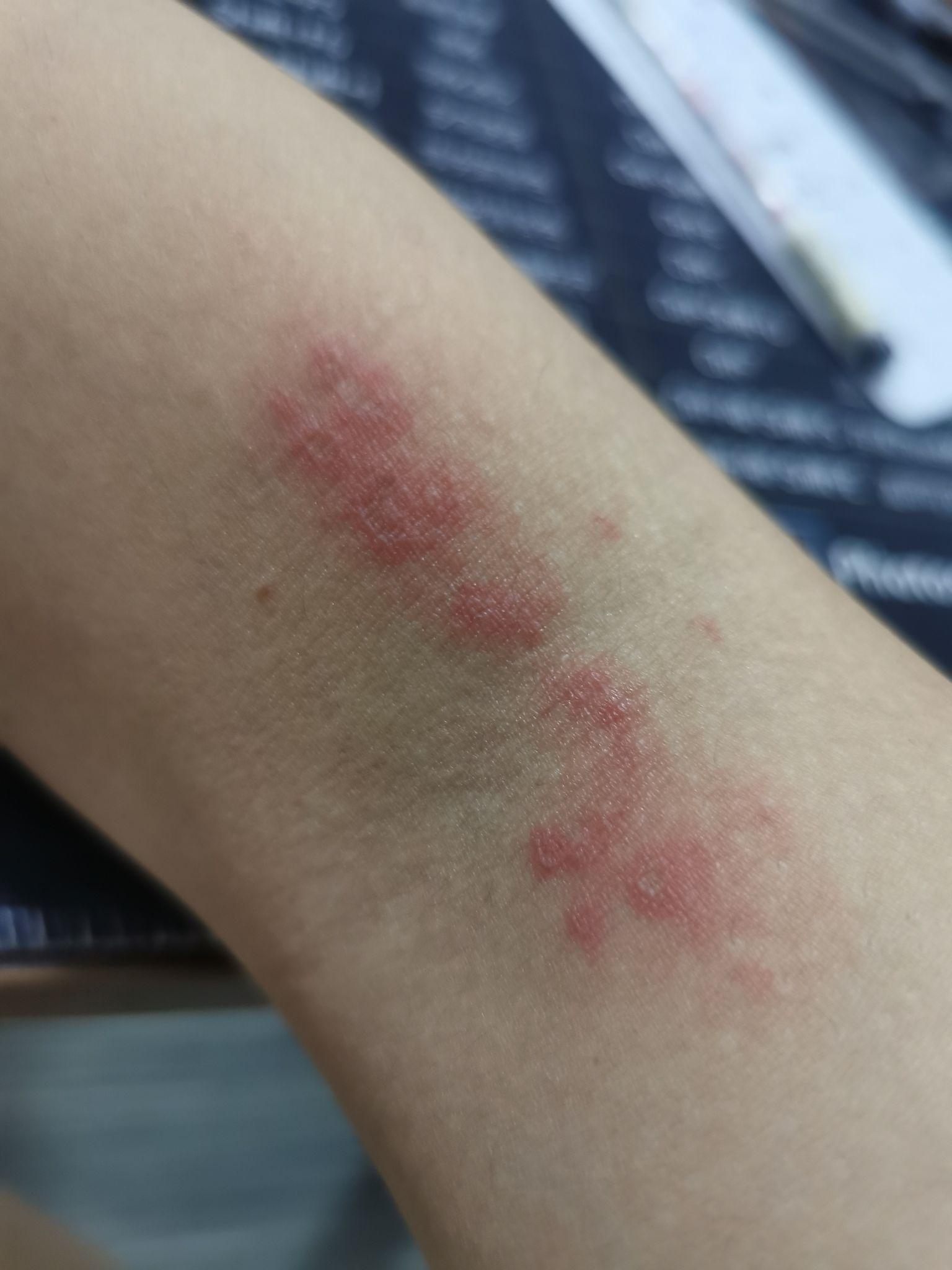 蜘蛛撒尿是什么样子的