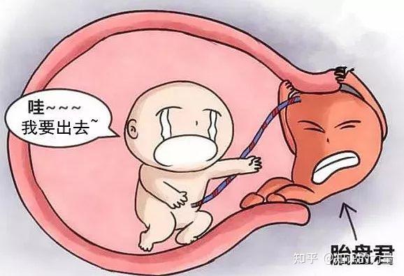 什么是胎盘前置?有没有孕妈知道的? - 知乎