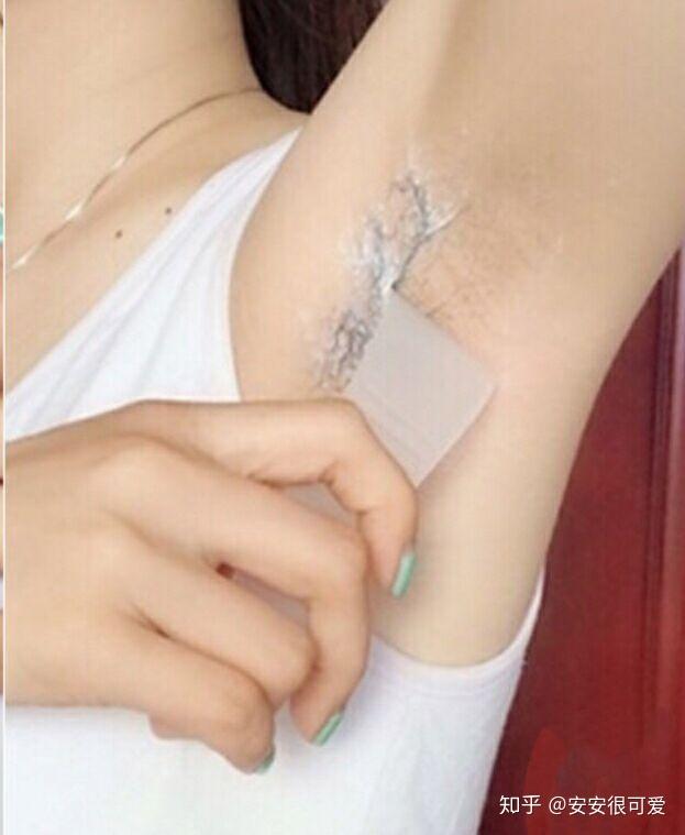 激光脱毛疼不疼?