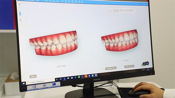 武汉存济小知识口扫是个啥凭什么被称为黑科技