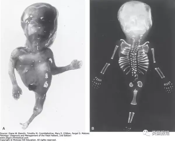 童话骗人!噩梦环绕的现实美人鱼