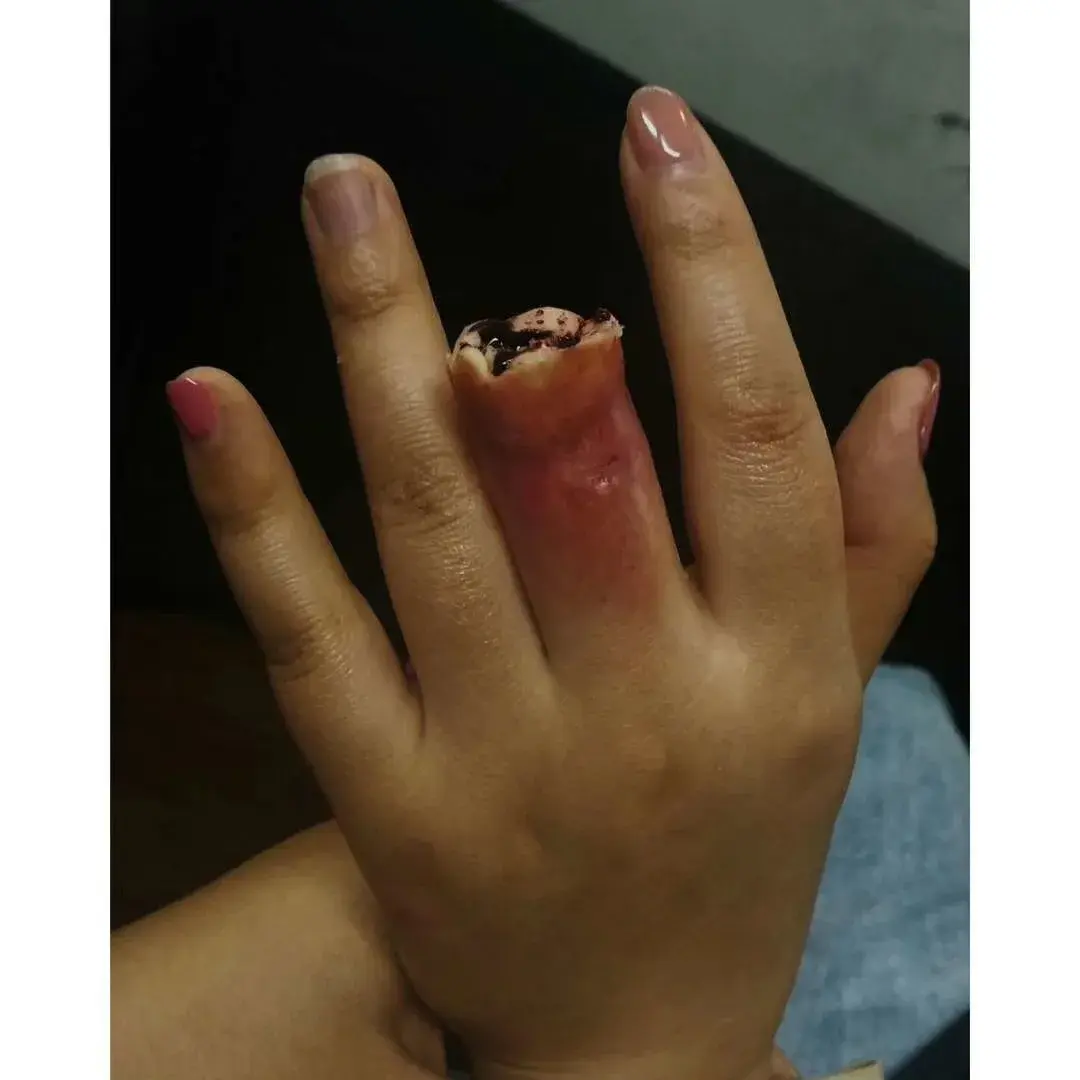 从mgp毕业后选择了到古月辰学校进修