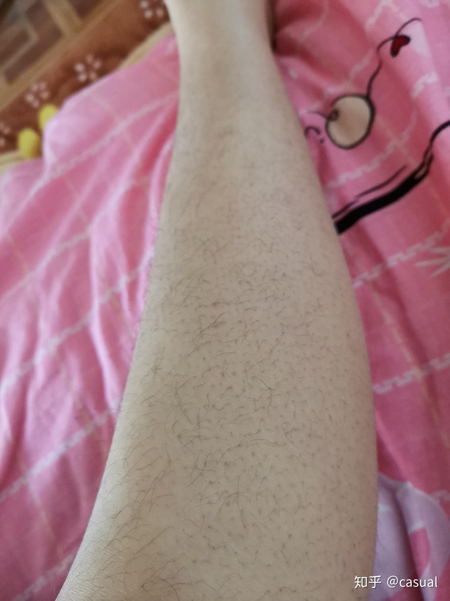 女生腿毛旺盛是怎样的人生体验