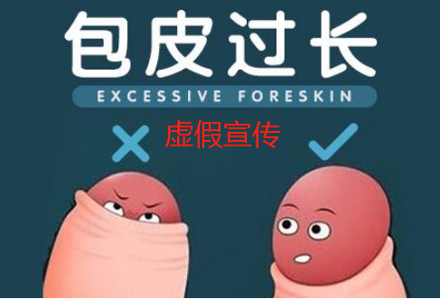 包皮手术需要割多长才合适呢