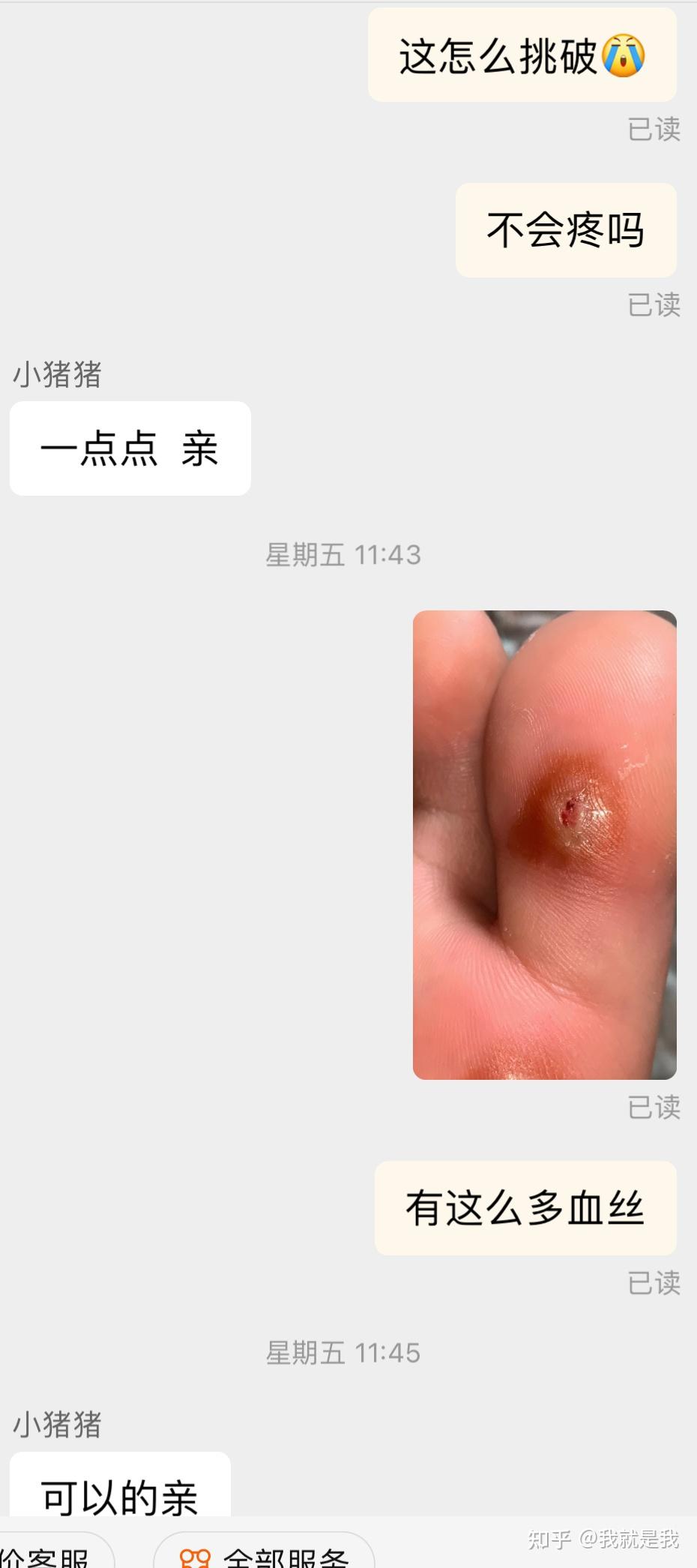 治跖疣最快偏方图片