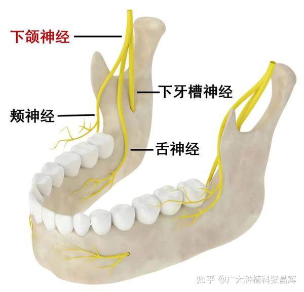 拔牙后的「危险」麻木感,要这样应对和处理#拔牙「并发症」 - 知乎