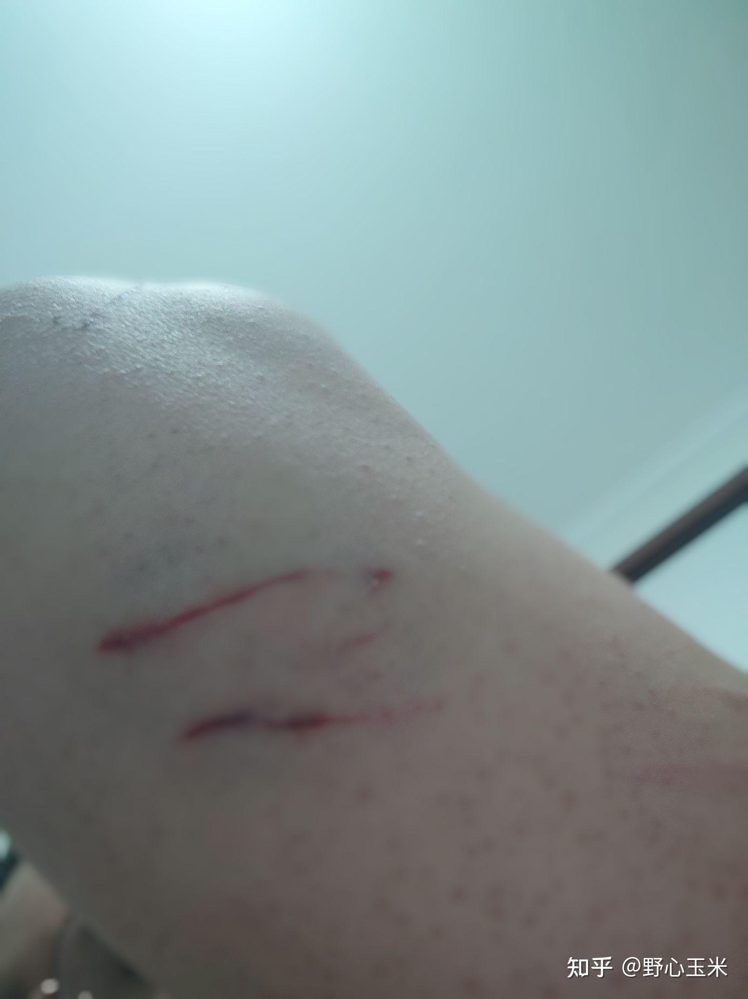 发疯的前兆有哪些 v2-b57d580ec968609af96f2a1fcc3019b4_r.jpg