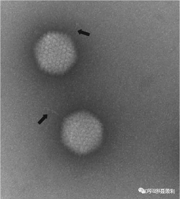 腺病毒电子显微镜照片