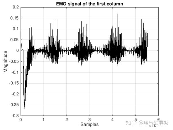 【数字化处理】仿生假体控制中肌电信号的数字化处理研究（matlab代码实现） 知乎