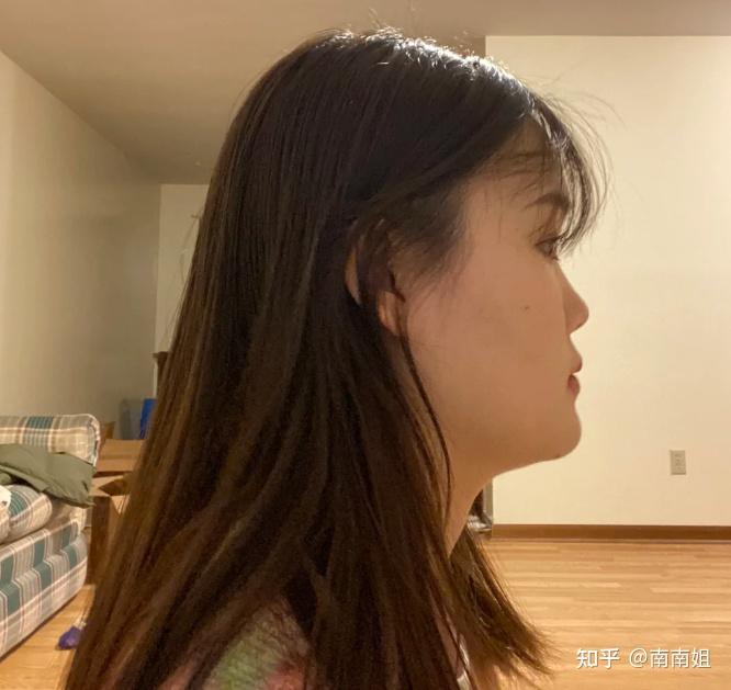 正脸好看但侧脸丑是什么体验需要怎么变美