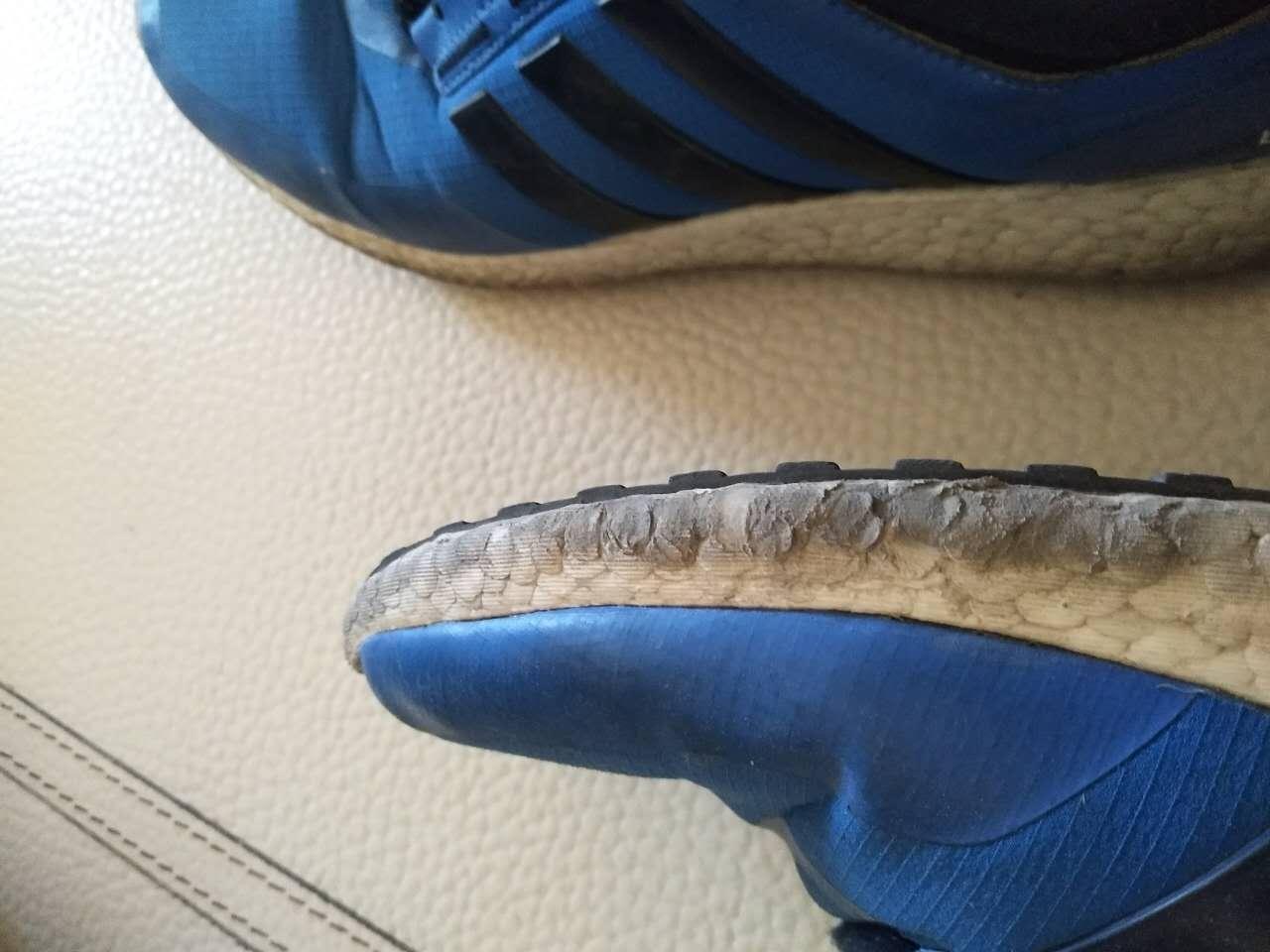 脚侧边烂了（舌头边边烂了怎么回事）