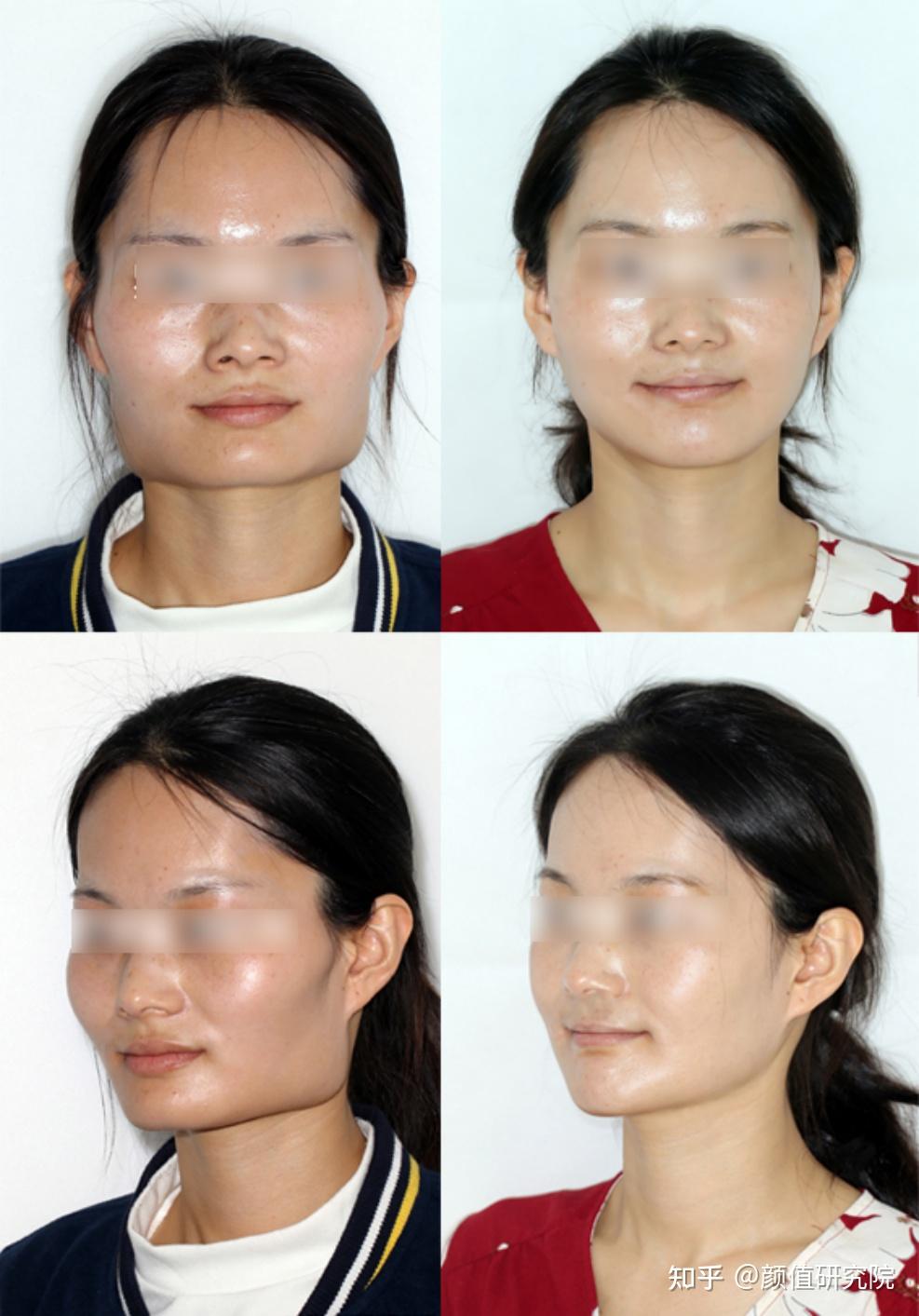 削骨医院成都重庆的有没有好的,价钱还适中的? - 知乎