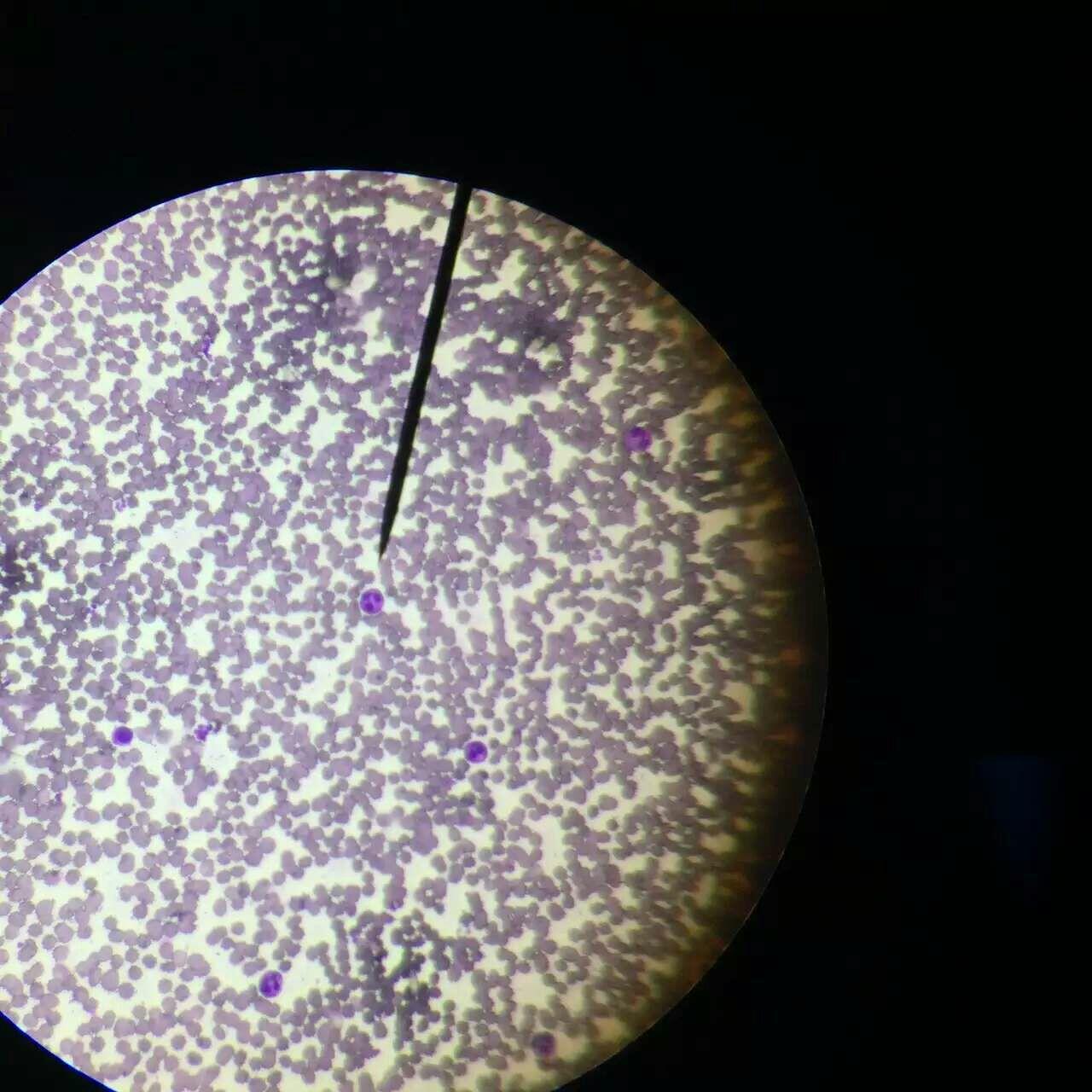 显微镜下观察白色念珠菌照片摄影图片_ID:332234908-Veer图库