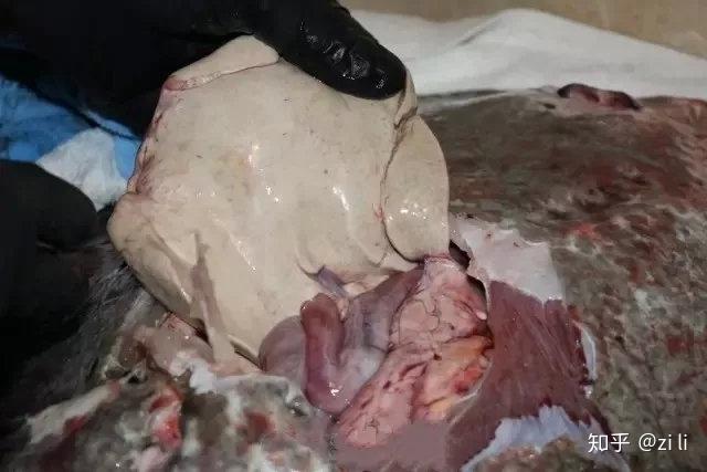 也没有明显的胆汁流出,毕竟我刀工了得幸运的没有破坏到内脏