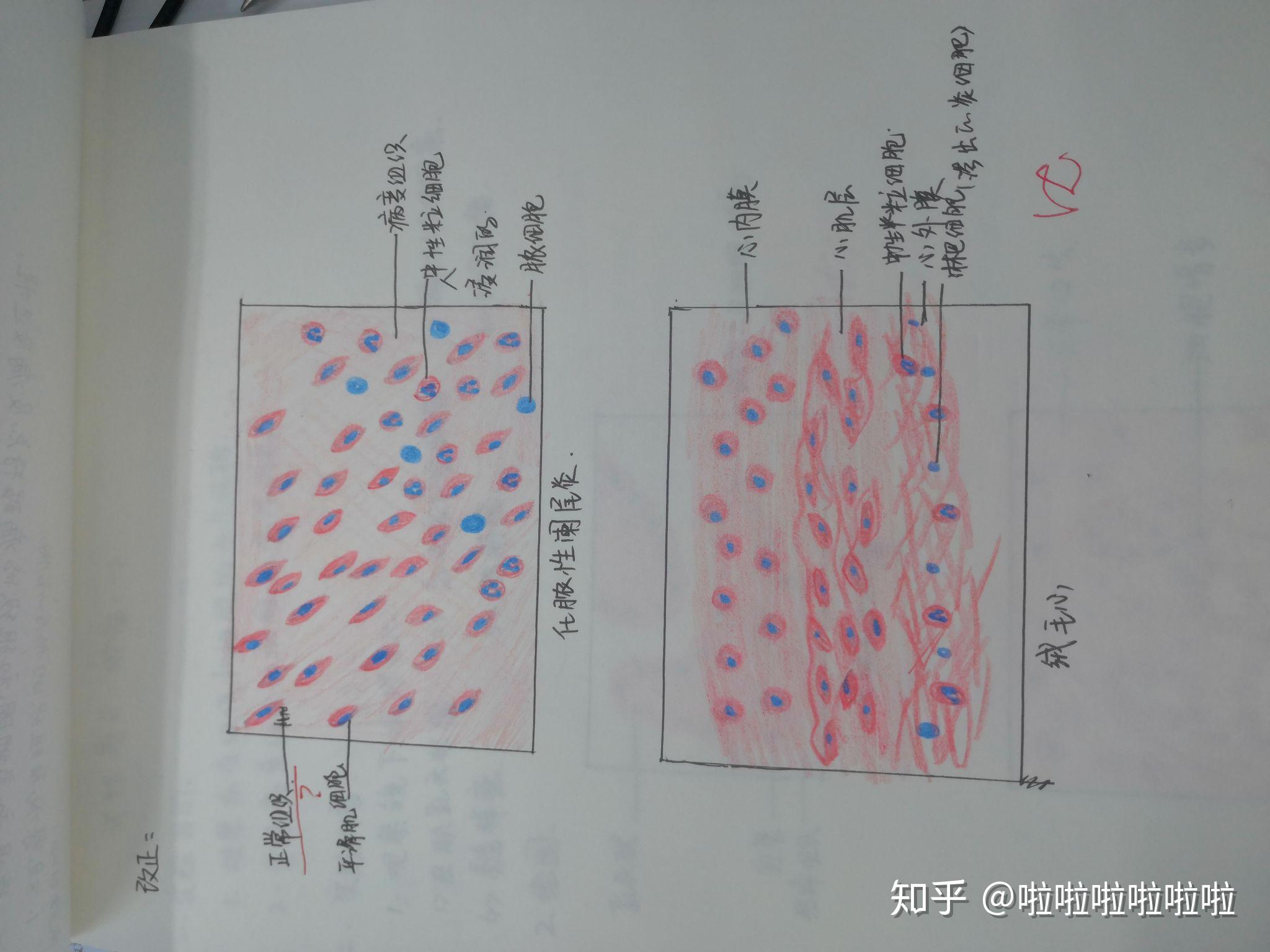 成纤维细胞手绘图he图片