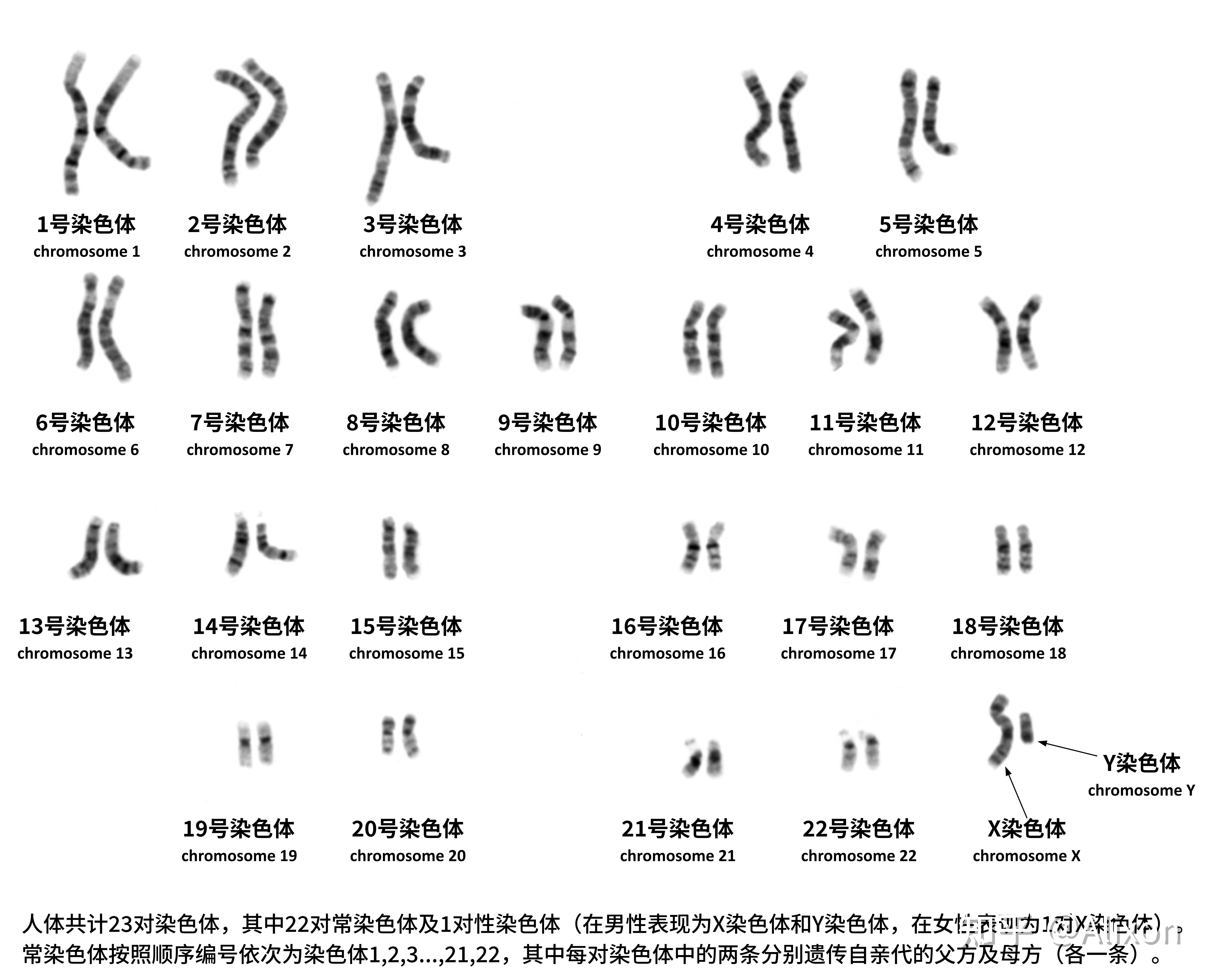 男性性染色体为x染色体(x chromosome)和y染色体