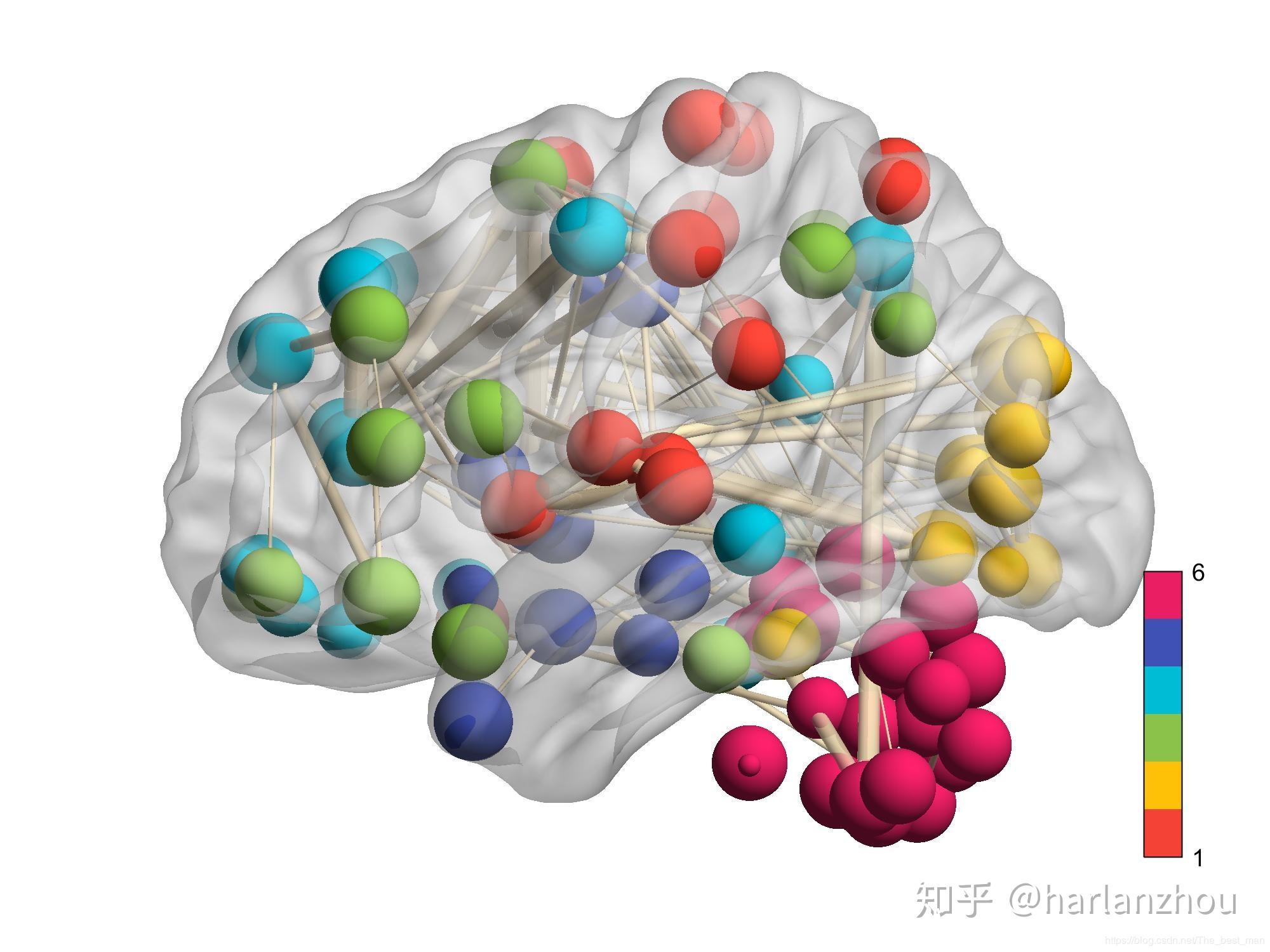 fmri