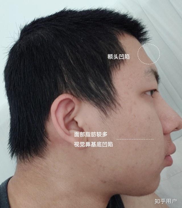 请问我的侧脸为什么感觉很丑? - 知乎