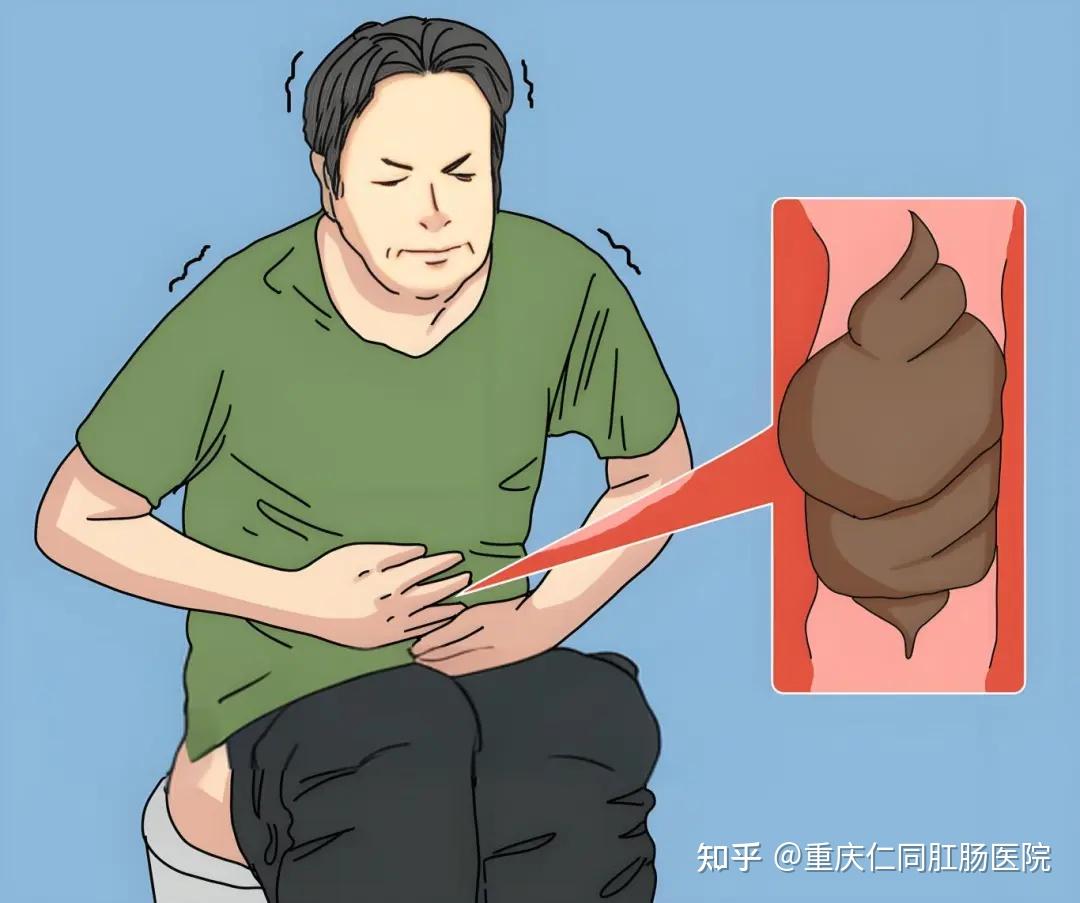 排便困难的时候怎么办啊?重庆仁同肛肠道医院? - 知乎