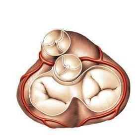 瓣膜相当于门卫,阻止血液回流于刚刚离开的心房(房室瓣)或心室(半月瓣