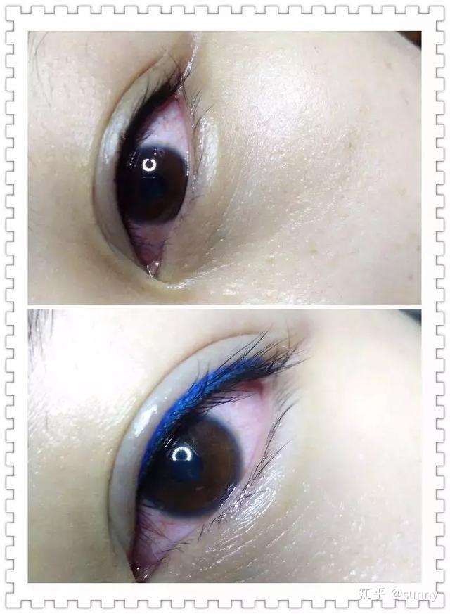 纹美瞳线做的太浅,发炎会使纹身的颜色迅速淡化.