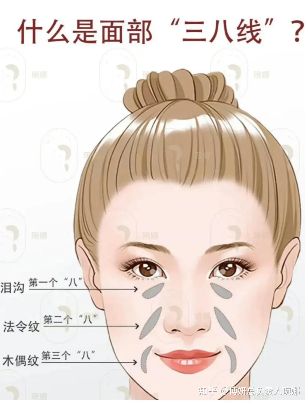 法令纹剥离到底好不好 - 知乎