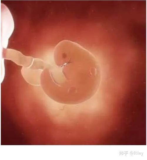 超 初期 出血 妊娠 妊娠超初期(生理予定日)の生理みたいな出血(茶色と鮮血)は妊娠だった。