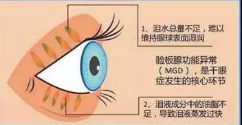 免疫球蛋白的作用与功效有哪些 v2-b774472b3d951cd10fe6316e54351e18_b.jpg