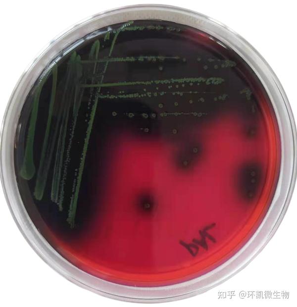 常见微生物菌落形态图及比较 - 知乎
