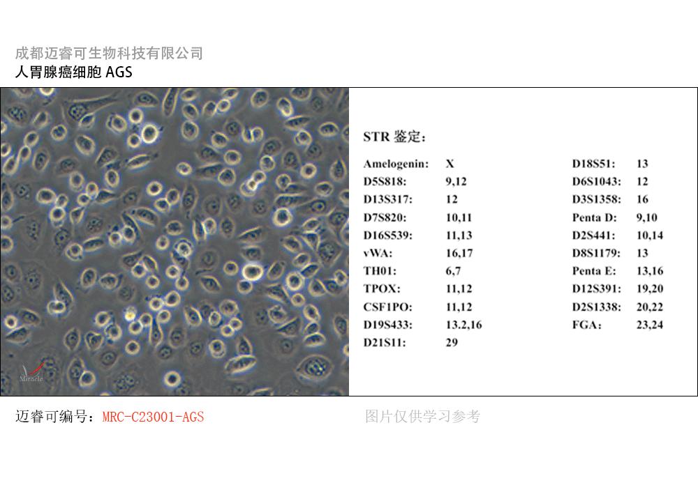 以AGS细胞为模型做胃癌研究，这些“坑”你踩过吗？ - 知乎