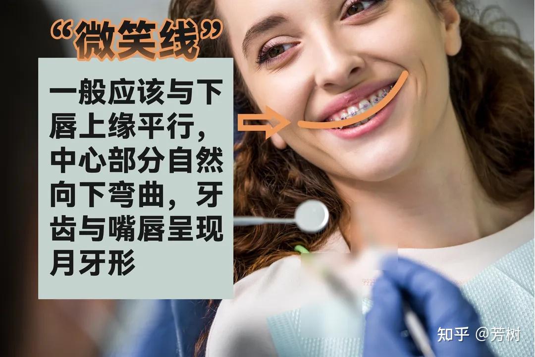 让一众明星笑起来这么美的“微笑线”究竟是什么？ - 知乎