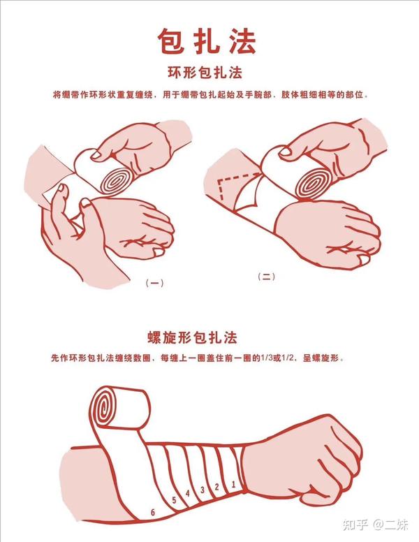 创伤之【止血包扎】 - 知乎