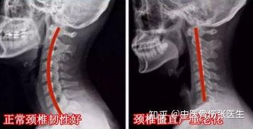 v2-b7f885e22a96264008cc6dc6c5378a70_b.jpg