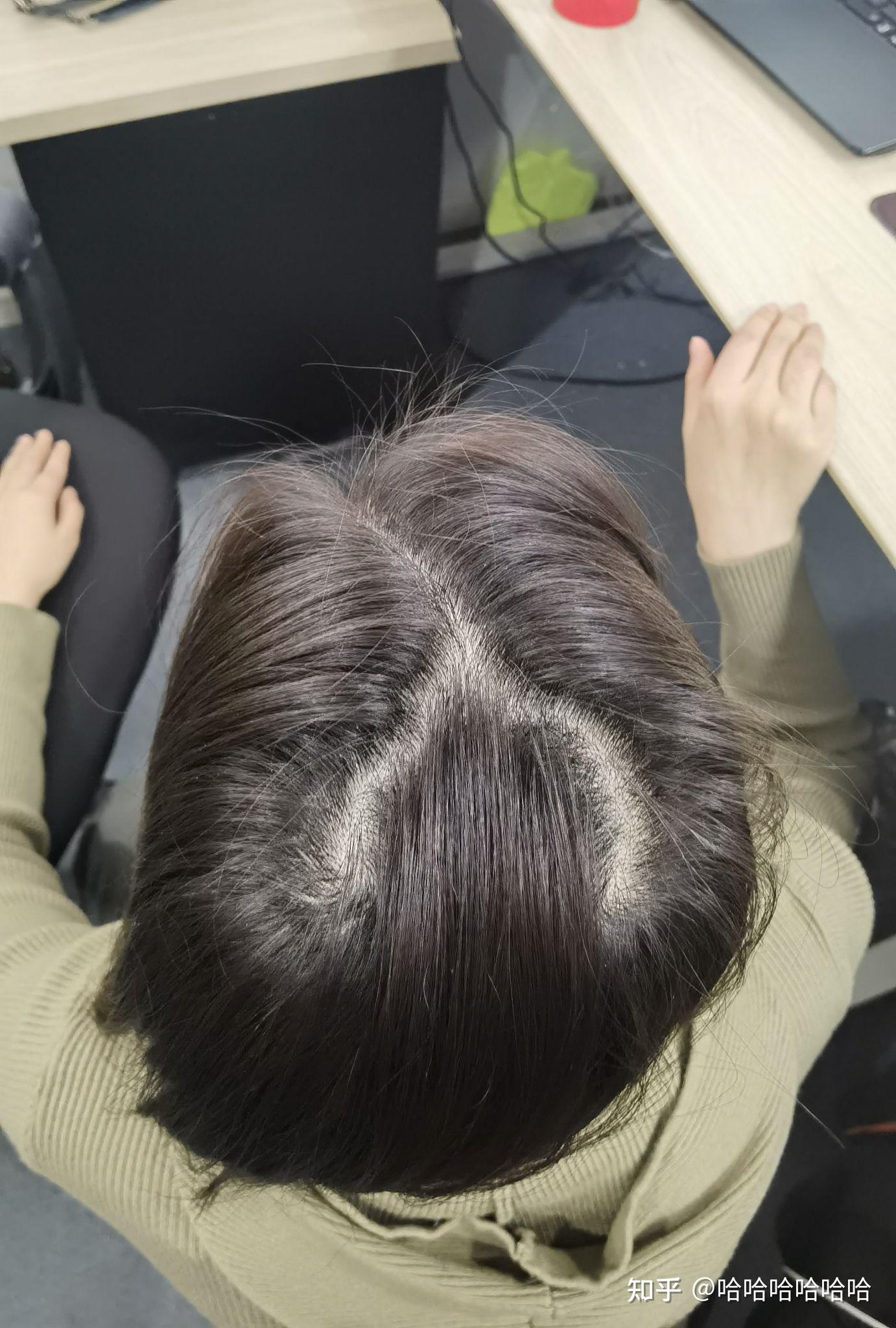 本来后脑勺上有两个旋,加上头发不多,就像个字母y,平时根本不敢披着