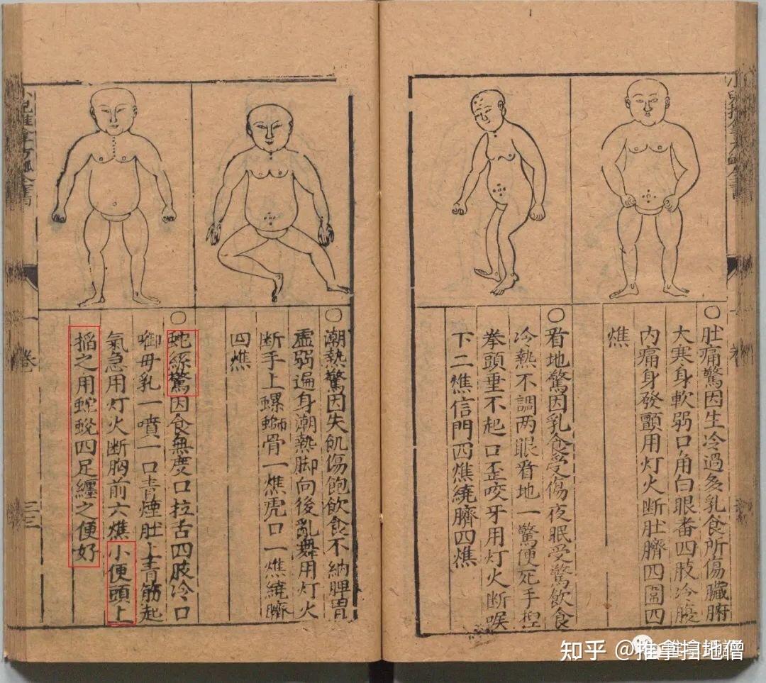 漫谈明代小儿推拿巫术成分及其文献价值