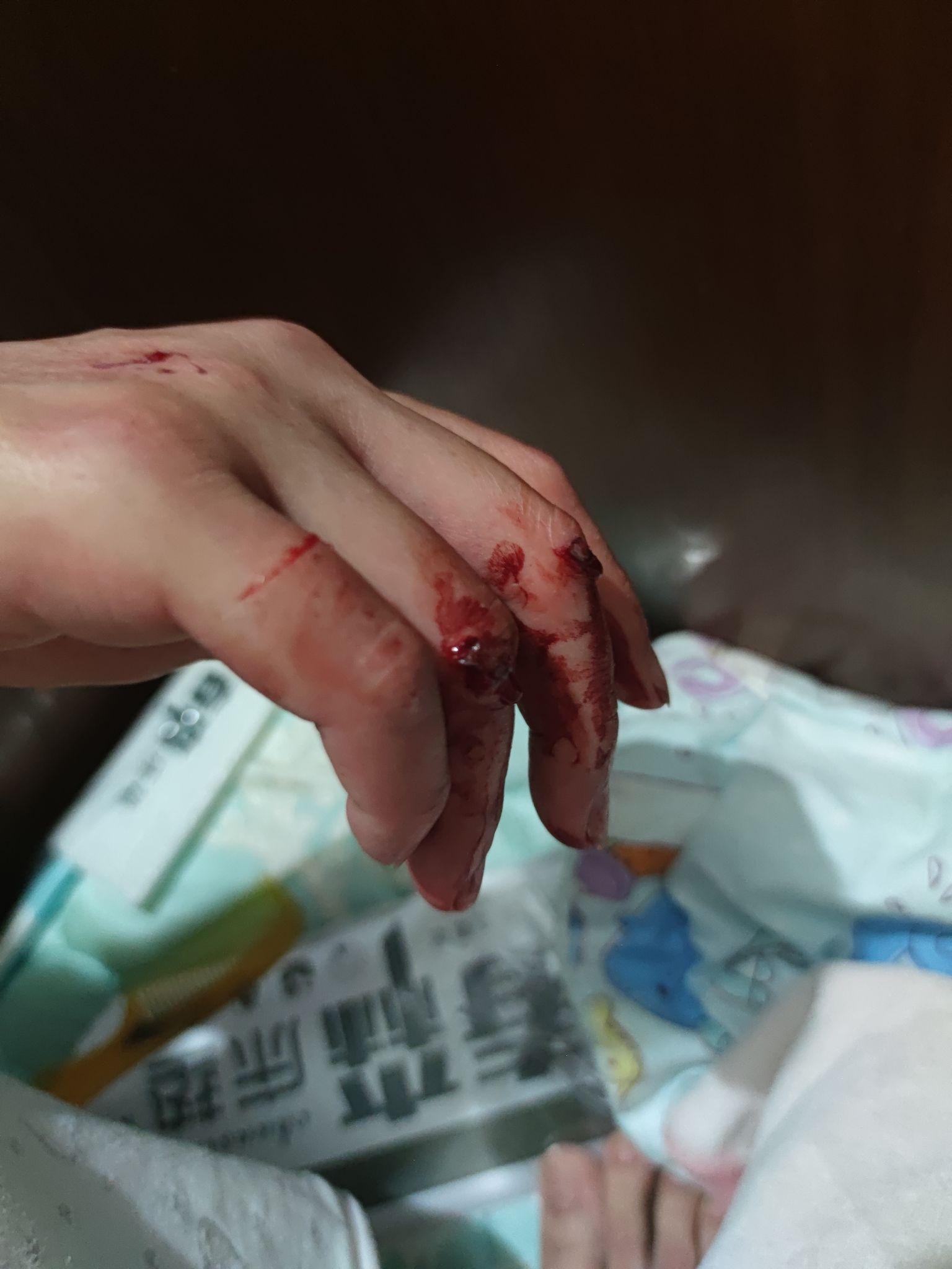 男朋友和我吵架砸墙,手都砸青了.他以后会有家暴倾向吗? - 知乎