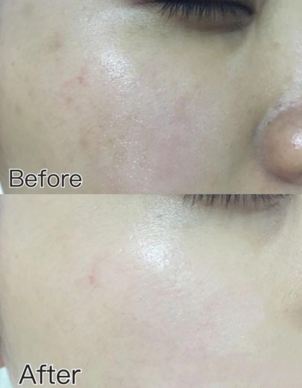 经常熬夜脸色暗黄如何让皮肤状态一夜回春