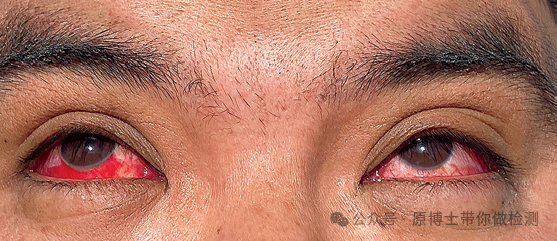 疑似感染甲型 h5n1 病毒的奶牛后,通过rt-qpcr 检测出高致病性禽流感