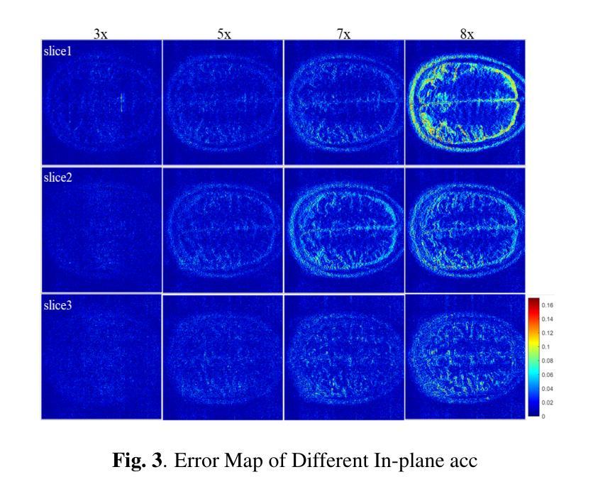 Diffusion Models