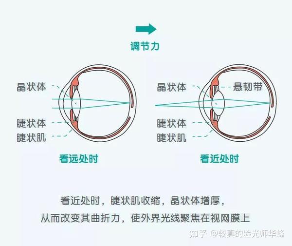 视功能检查-什么是眼睛的调节力?和近视有啥关系?通俗版,家长一看就懂得回答 - 知乎