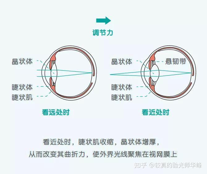 什么是眼睛的调节力和近视有啥关系通俗版一看就懂得回答