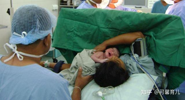 产妇顺产转剖宫产手术医生询问谁签字她的回答很硬气