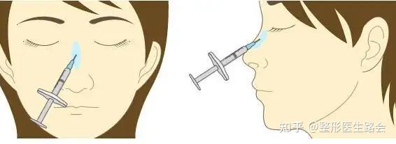 整形医生坦白:这3种医美项目,失败率高且难修复,尤其最后一种! - 知乎