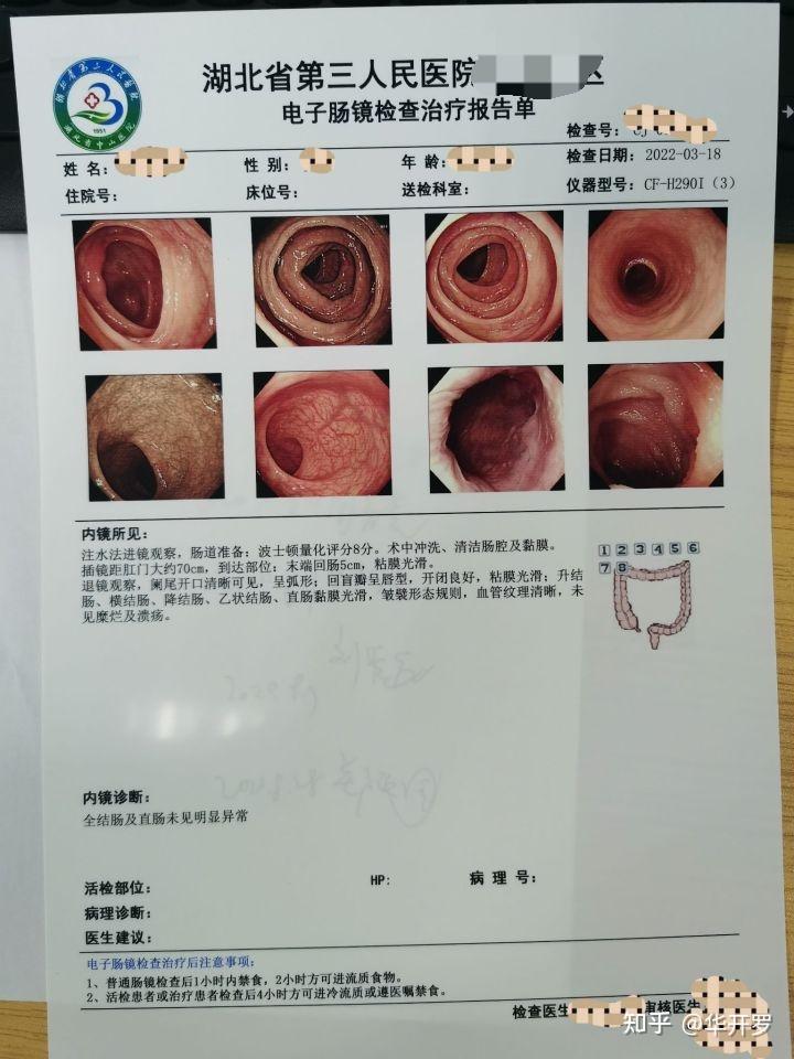 肠镜报告图片怎么看图片