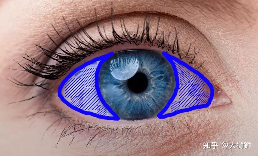 方便大家理解:人的眼睛表面外层由角膜和巩膜组成(红色 蓝色的部分)
